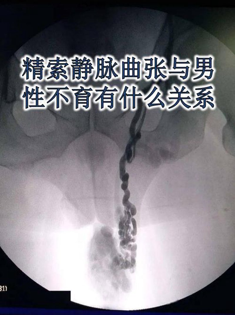 选择泌尿外科医院的全面指南