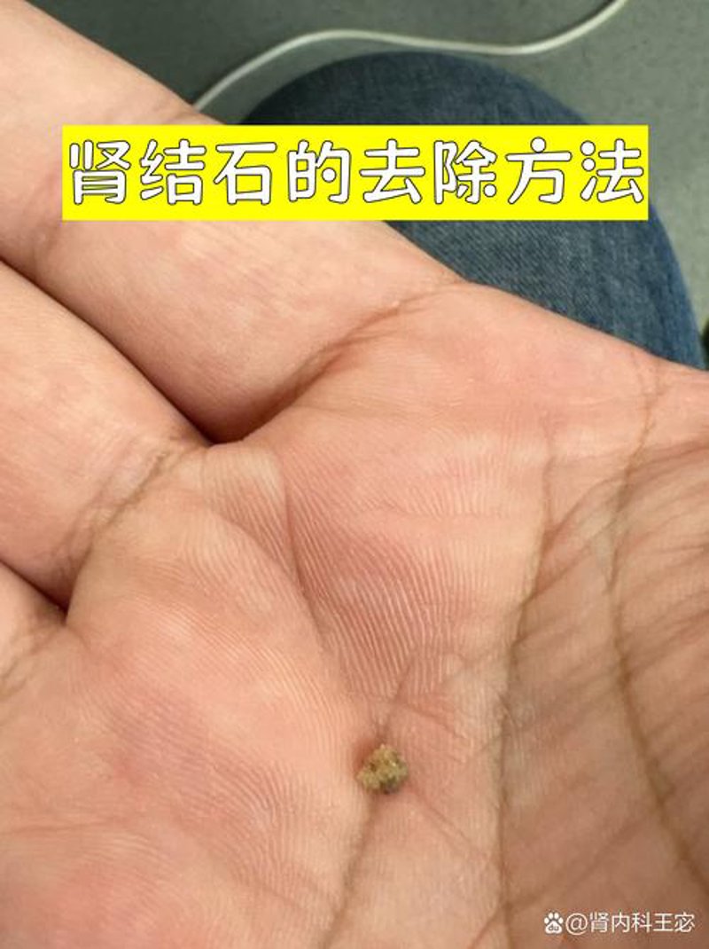 选择靠谱泌尿外科医院的五大要点